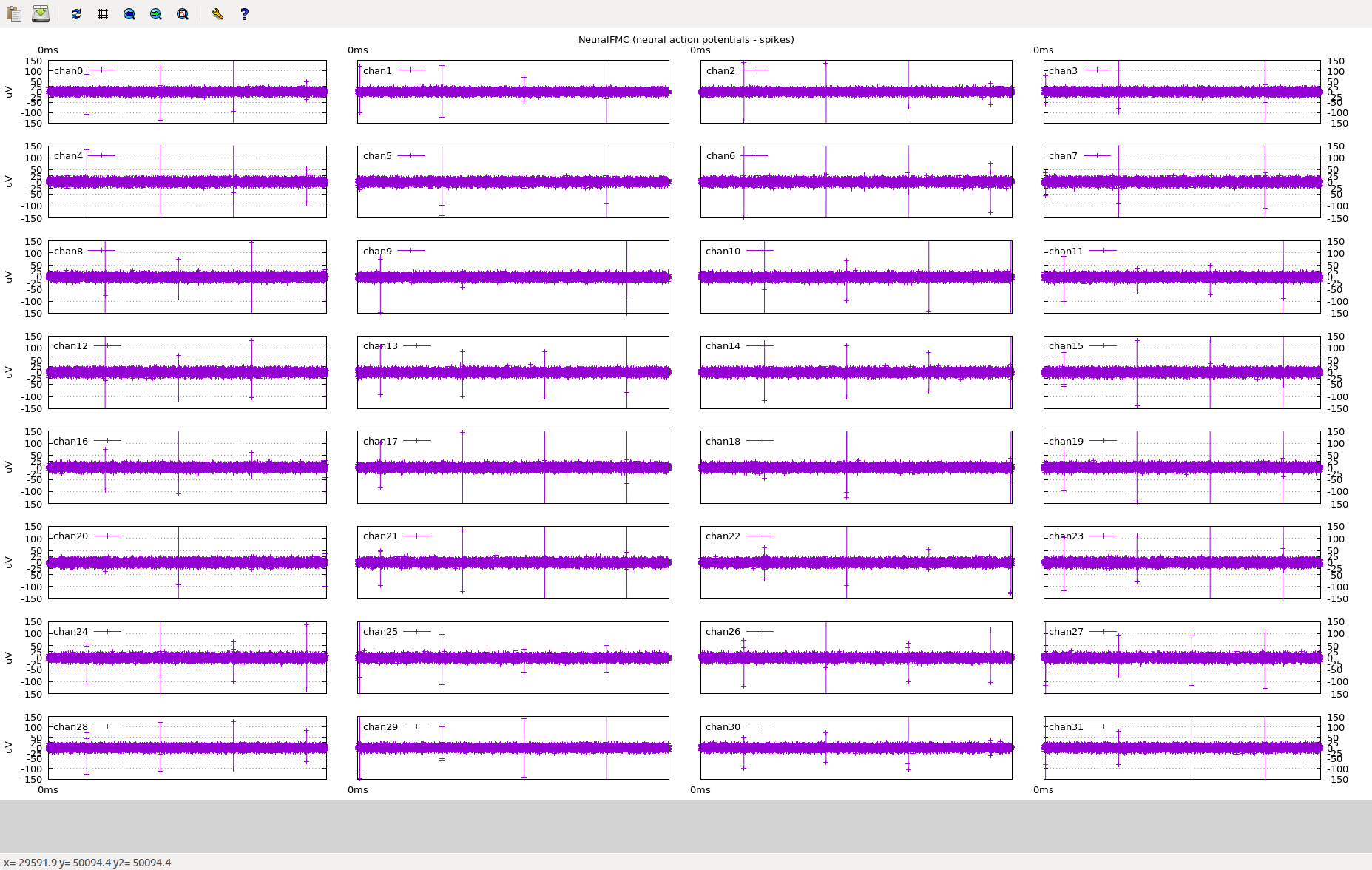 NeuralFMC 32 chChannels